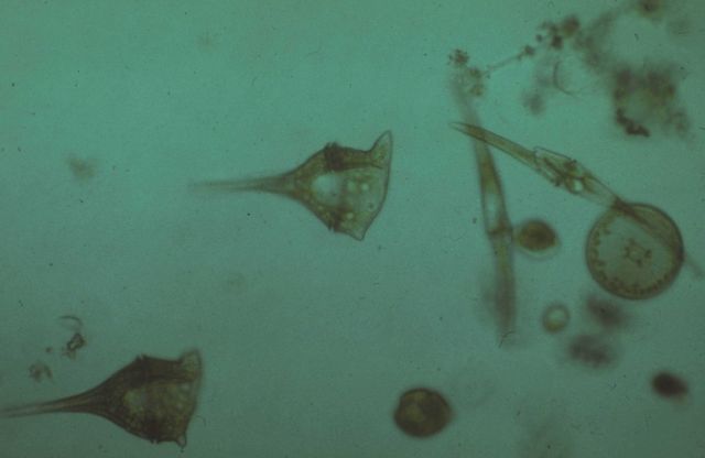 Zooplankton - 1/5 inch worm plankton Picture