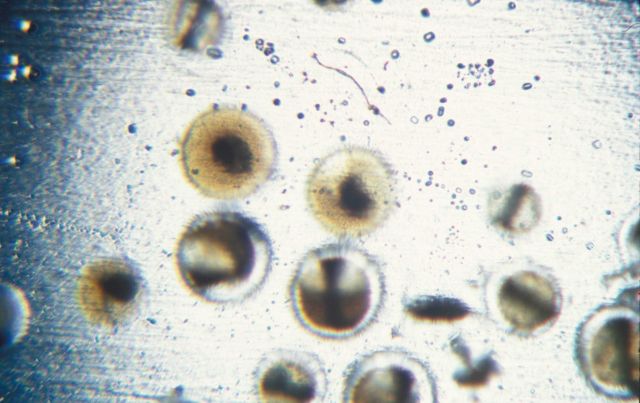Fish eggs seen under the microscope Picture