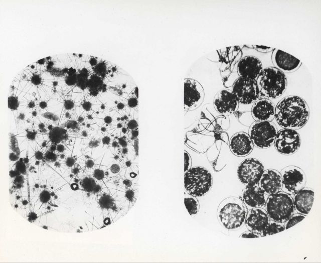 Phytoplankton dominated by Ahlosphaera with Ceratium longipes from a surface haul. Picture