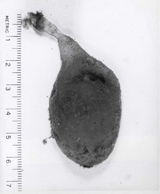 Egg capsule of the lugworm (Arenicola cristata) from Tampa Bay Picture