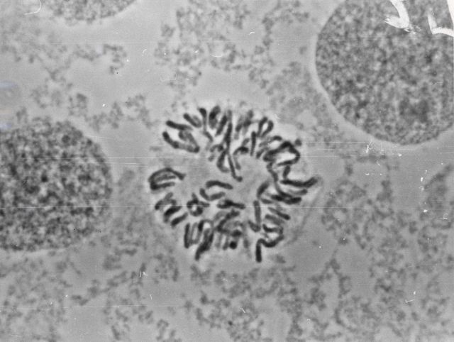 Chromosomes provide vital clues in studies of coregonid genetics that seek to explain the complex changes in whitefish and cisco stocks of the Great L Picture