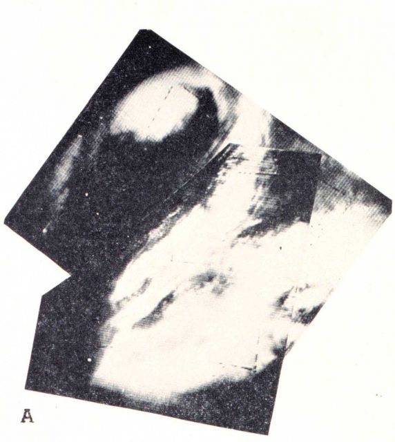 Two overlapping TIROS I images showing extratropical cyclone centered over southeastern Nebraska Picture