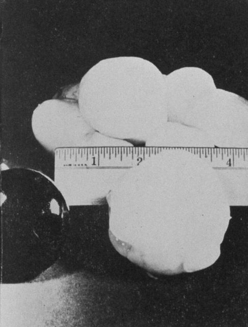 Hailstones compared to doorknobs Picture