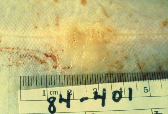 The introduction of toxins into the marine environment have drastic effects on the organisms that live there Picture