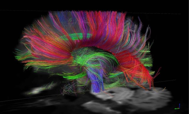 Multicolored image of connectome Picture