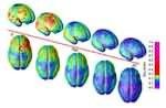 Constructed from MRI scans of healthy children and teens, the time-lapse 'movie', from which the above images were extracted, compresses 15 years of b Picture