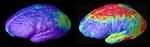 Composite MRI scan data showing areas of gray matter loss over 5 years, comparing 12 normal teens (left) and 12 teens with childhood onset schizophren Picture