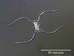 Chaetoceros atlanticus from the far northwestern Pacific. Image