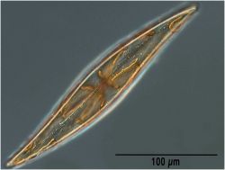 Pleurosigma strigossum (probably) from the Bay of Villefranche. Image