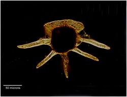Ceratocorys sp Image