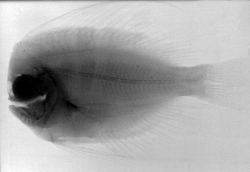 An X-ray of a Bigmouth Manefish . Image