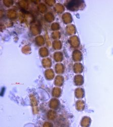 Melosira nummuloides - live specimen Image