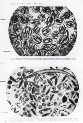 Plankton dominated by the Ctenophore Pleurobrachia pileus with a barnacle (Balanus) larvae in the 'nauplius
