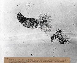A single parasite (Gyrodactylus) showing the basal hooks by which it attaches itself to the skin Image
