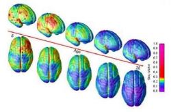 MRI scans of healthy children and teens shows 15 years of brain development ages 5â20 and the 