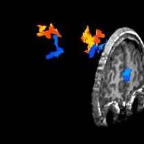 fMRI image slice of middle brain activity Image